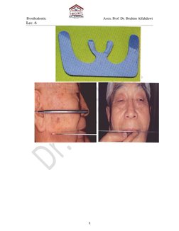  Prosthodontic                     
                  Assis. Prof. Dr. Ibrahim Alfahdawi 
Lec. 6 
5 
 
 
  
 
