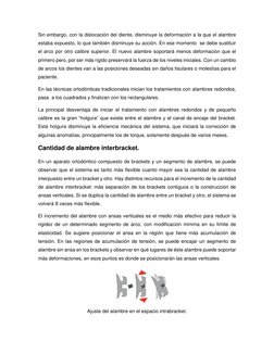 Sin embargo, con la dislocación del diente, disminuye la deformación a la que el alambre 
estaba expuesto, lo que también dis
