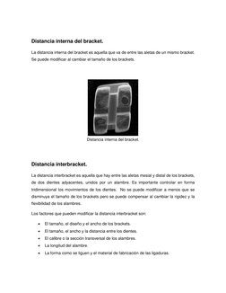 Distancia interna del bracket. 
La distancia interna del bracket es aquella que va de entre las aletas de un mismo bracket.