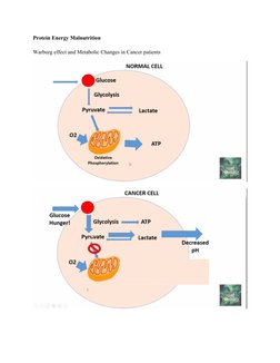 Protein Energy Malnutrition
Warburg effect and Metabolic Changes in Cancer patients 
