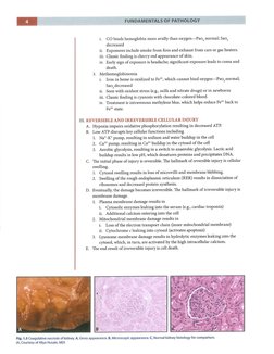 Chapter 2 Pathoma Notes.pdf PATHOMA | PDF | Self-Improvement | Wellness