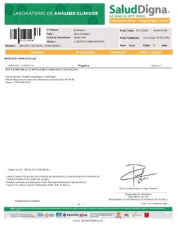 Nº Cliente:
25449639
Fecha Toma:   09/12/2020
08:00:19AM
Folio :
201110108062
8
Fecha de Nacimiento:
Médico:
09/06/1989
A QUI