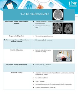 TAC DE CRÁNEO SIMPLE
Indicaciones para la realización del
estudio. 

Tumores cerebrales a estudio d