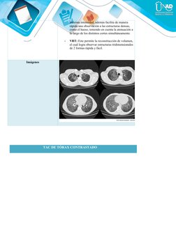máxima intensidad, además facilita de manera 
rápida una observación a las estructuras densas, 
como el hueso, teniendo en cu