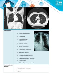 Indicaciones

Masas mediastinales.

Neumonías.

Malformaciones
arteriovenosas.

Trauma de tórax.                

Hemo n