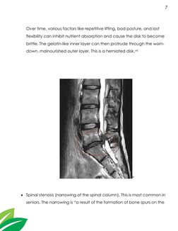7 
 
Over time, various factors like repetitive lifting, bad posture, and lost 
flexibility can inhibit nutrient absorption a