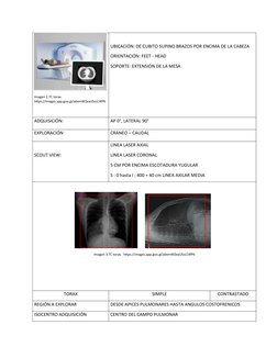 Imagen 2.TC torax.  
https://images.app.goo.gl/abxmWZeaUSsLC4fP6
UBICACIÓN: DE CUBITO SUPINO BRAZOS POR ENCIMA DE LA CABEZA
O