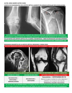 AUTOR: JORGE ANDRÉS CASTRO FLORES 
EJEMPLOS DE RADIOGRAFÍAS CON ARTRITIS SÉPTICA (AUMENTO DEL ESPACIO ARTICULAR POR ACUMULACI
