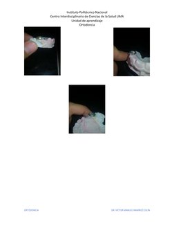 Instituto Politécnico Nacional 
Centro Interdisciplinario de Ciencias de la Salud UMA 
Unidad de aprendizaje 
Ortodoncia 
 
O