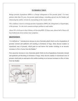 INTRODUCTION
Benign prostatic hyperplasia (BPH) is a benign enlargement of the prostate gland. • In many
patients older than