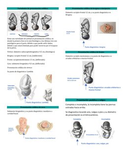 Variedades de presentación cefálica: 
 
Estas son variedades de actitud en presentación cefálica, en 
donde la primera foto e