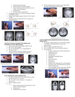Petrous Ridge Positioning Chart Skull Radiography Positioning Methods | PDF | Skull | Anatomy