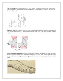 Spiral bandage: the bandage ascends in a spiral manner so that each turn overlaps the preceding 
one by one half or two-third