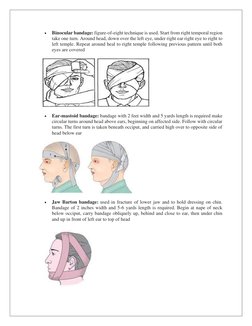 • 
Binocular bandage: figure-of-eight technique is used. Start from right temporal region 
take one turn. Around head, down o