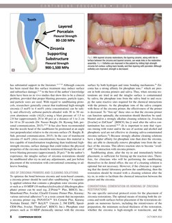 5
OCTOBER 2022
COMPENDIUM EBOOK
C O N T I N U I N G  E D U C A T I O N  •  2  C E U
5
COMPENDIUM EBOOK
surface by both hydrog
