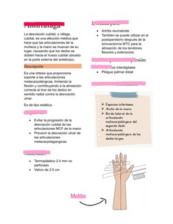 Antirrafaga 
La desviación cubital, o ráfaga 
cubital, es una afección médica que 
hace que las articulaciones de la 
muñeca