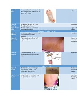 Signo del 
talón
Dolor en la fosa iliaca izquierda al 
dar 2 o 3 golpes en el talón con la 
palma de la mano.
Apendicit
Signo