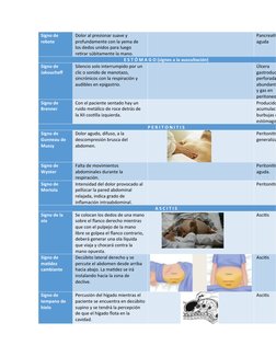 Signo de 
rebote
Dolor al presionar suave y 
profundamente con la yema de 
los dedos unidos para luego 
retirar súbitamente l
