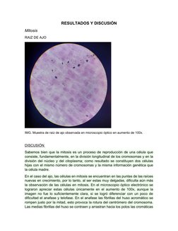 RESULTADOS Y DISCUSIÓN
Mitosis
RAIZ DE AJO
IMG. Muestra de raíz de ajo observada en microscopio óptico en aumento de 100x.
DI