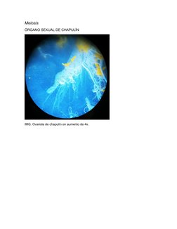 Meiosis
ÓRGANO SEXUAL DE CHAPULÍN 
IMG. Ovariola de chapulín en aumento de 4x.
