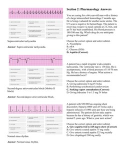 Supraventricular tachycardia
Answer: Supraventricular tachycardia.
Second-degree atrioventricular block (Mobitz II 
block)
An