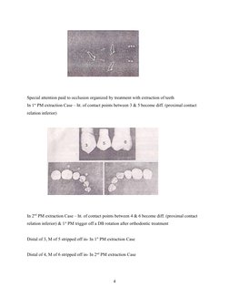 Special attention paid to occlusion organized by treatment with extraction of teeth
In 1st PM extraction Case – ht. of contac