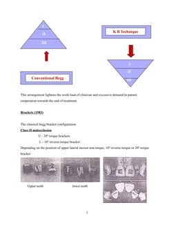 This arrangement lightens the work load of clinician and excessive demand in patient 
cooperation towards the end of treatmen