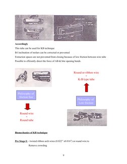 Accordingly
This tube can be used for KB technique
B-l inclination of molars can be corrected or prevented
Extraction spaces