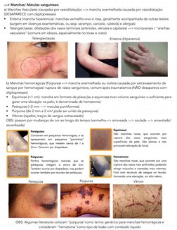 b) Manchas hemorrágicas (Púrpuras) —> mancha avermelhada ou violeta causada por extravasamento de 
sangue por hemorragias/ ru