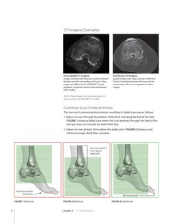 Prophecy Inbone Guide PROPHECY INBONE Surgical Technique | PDF | Ct Scan | Medical Imaging
