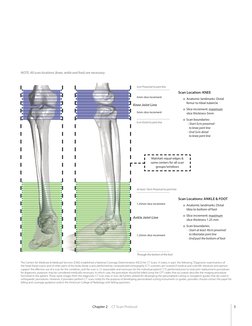 Prophecy Inbone Guide PROPHECY INBONE Surgical Technique | PDF | Ct Scan | Medical Imaging