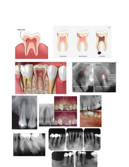 Clasificación AAE Endodoncia 2009 | PDF | Odontología | Ciencias de la ...