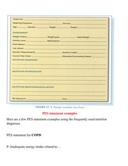 PES statement examples
Here are a few PES statement examples using the frequently used nutrition 
diagnoses.
PES statement fo