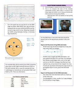 ELECTROOCULUGRAM (EOG) 
EO1 
Left eye 
EO2 
Right eye 
M1 
Left mastoid 
M2 
Right Mastoid 
EOG1 
LEOG 
EOG2 
REOG