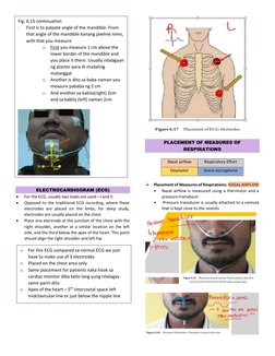 ELECTROCARDIOGRAM (ECG) 
• 
For the ECG, usually two leads are used—I and II. 
• 
Opposed to the traditional ECG recording,
