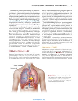 restrinja el movimiento del cuello fijando la cabeza del 
paciente mientras se afloja el collar. Observe la pared 
torácica p