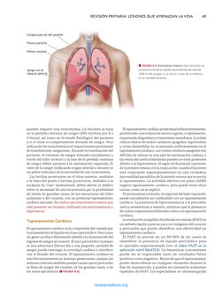 pueden requerir una toracotomía. La decisión se basa 
en la pérdida continua de sangre (200 ml/hora por 2 a 
4 horas), así co