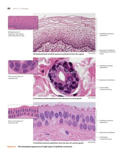 86   UNIT 6 | Histology
Underlying connective 
tissue
Basement membrane
LM (350×)
Stratified squamous 
epithelium
LM (1270×)