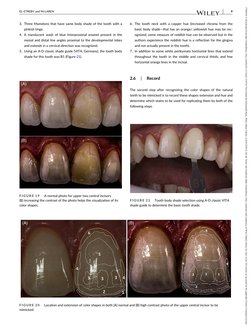 Translucent Shade Tooth Techniques for Ideal Tooth Color Matching | PDF | Human Tooth | Dentistry