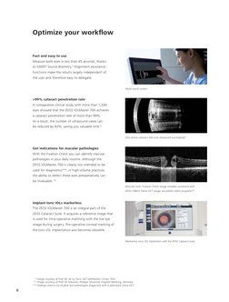 Iolmaster Surgery Guide.pdf Brochure Iolmaster 700 Modf | PDF | Facial Features | Clinical Medicine