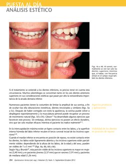 284  Quintessence técnica (ed. esp.). Volumen 23, Núm. 5. Septiembre-Octubre 2012 
PUESTA AL DÍA
ANÁLISIS ESTÉTICO
Si el trat