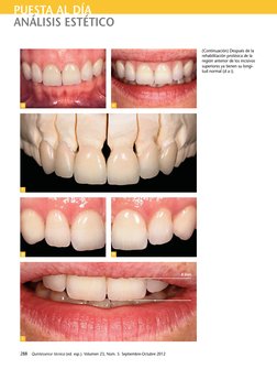 288  Quintessence técnica (ed. esp.). Volumen 23, Núm. 5. Septiembre-Octubre 2012 
PUESTA AL DÍA
ANÁLISIS ESTÉTICO
4 mm
d
e
f