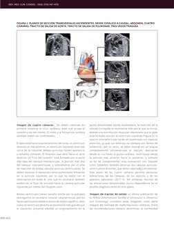 450
Imagen de cuatro cámaras.  Se deben observar en 
primera instancia el situs cardíaco, área que ocupa el 
corazón y eje de