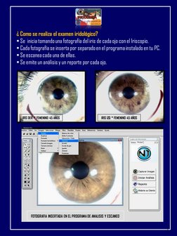 ¿ Como se realiza el examen iridológico?
Se  inicia tomando una fotografía del iris de cada ojo con el Iriscopio.
Cada foto