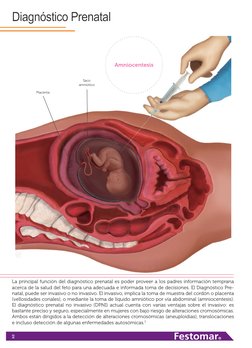 2
Diagnóstico Prenatal
La principal función del diagnóstico prenatal es poder proveer a los padres información temprana 
acer