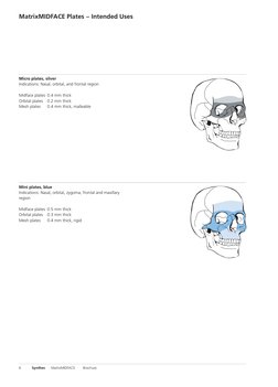 6
Synthes
MatrixMIDFACE
Brochure
MatrixMIDFACE Plates – Intended Uses
Micro plates, silver
Indications: Nasal, orbital, and f