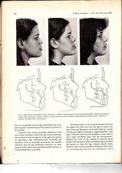 Soft Tissue Cephalometric Analysis For Orthognathic Surgery | PDF