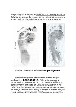 7
fotopodograma se puede conocer la morfología exacta 
del pie, las zonas de más presión y sirve además para 
poder realiza