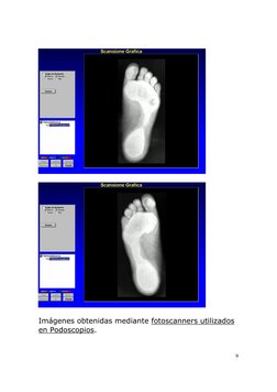  
9
 
 
 
 
 
Imágenes obtenidas mediante fotoscanners utilizados 
en Podoscopios. 
 

