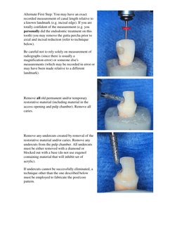 Cast Post and Core Fabrication Guide | PDF | Dentistry Branches | Dentistry